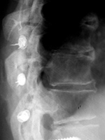 Wisconsin wires lateral view